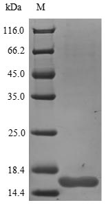 Rat Ngf protein