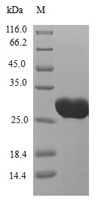 Human CT83 protein