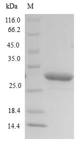 Bacterial lktA protein