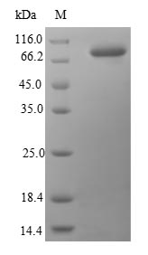 Human HSP90AB1 protein