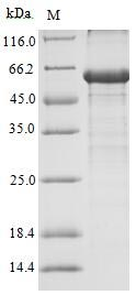 Human AR protein