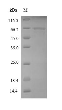 Human EEF1A1 protein