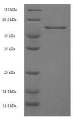human CXCR4 protein