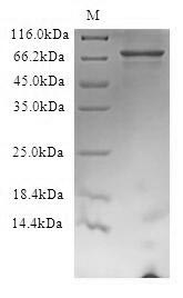Human FBXW7 protein
