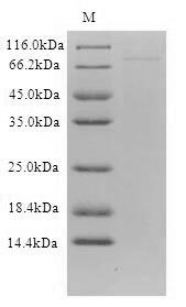 Human DCP1B protein