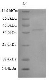 Dog Anionic trypsin protein