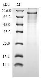 human PIBF1 protein