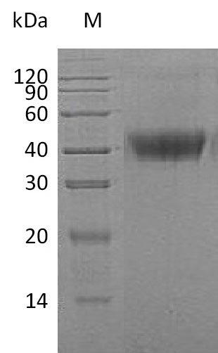 Human CSF1 protein