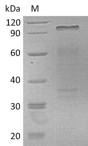 Human IL6 protein