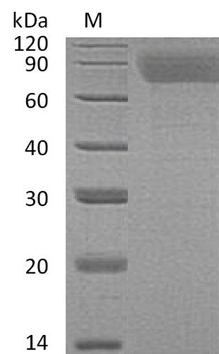Human THPO protein