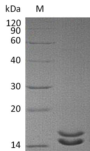 Human IL2 protein
