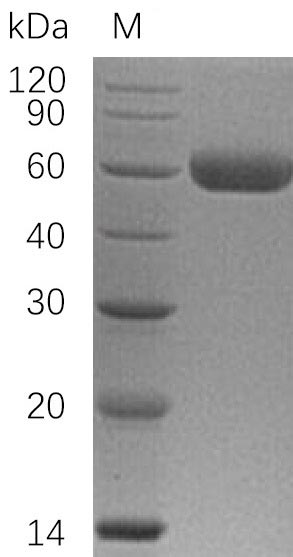Human OPG protein