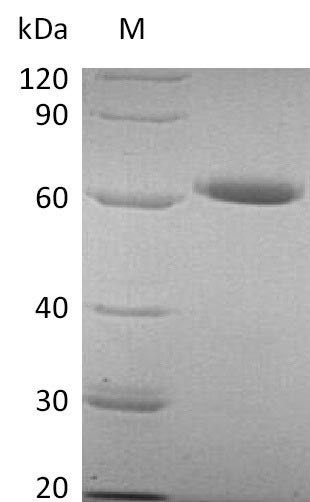 Human NT5E protein