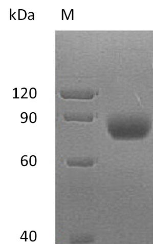 Human MICA protein
