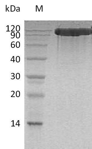 Human ACE2 protein