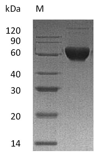 Human ACVR2B protein