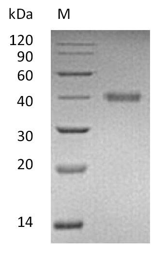 Human RSPO1 protein
