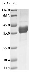 Human ASPA protein
