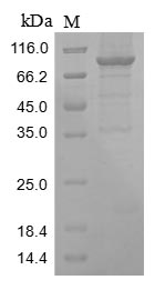 Human ENO1 protein