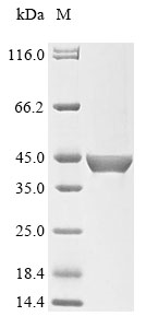 Human FSHR protein