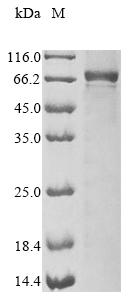 Mouse Irak3 protein
