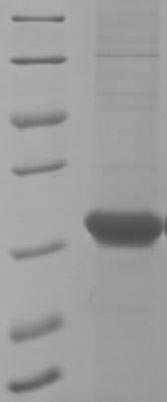 Human RCVRN protein