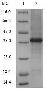 Human Versican protein