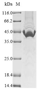 Virus Measles virus Nucleoprotein(N) protein