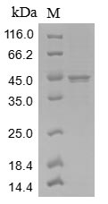 Virus Measles virus Nucleoprotein(N) protein