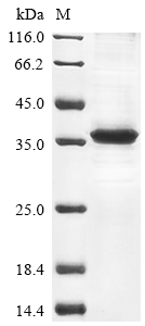 Human DNASE1L3 protein