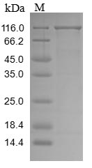 Human VPS35 protein