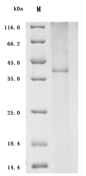 Human CCR4 protein