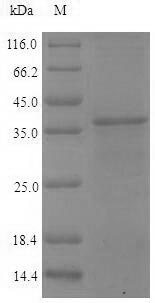Virus PS/HR protein