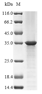 E. coli ompA protein