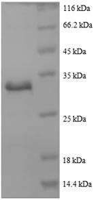 Human ACTB protein