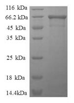 Human ALDOA protein