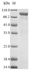 Human APEH protein