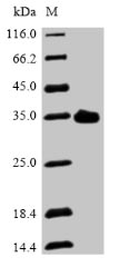 Mouse Asgr2 protein