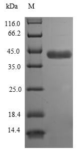 Human ASPA protein