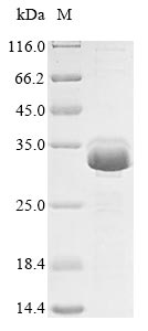 Human CALM1 protein