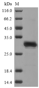 Human CAMK2N1 protein