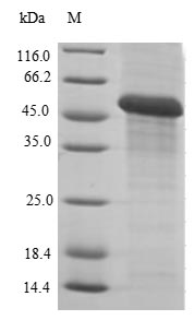 Human CBR1 protein