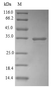 Human CBR1 protein