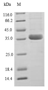 Human MCP1 protein