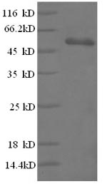 Human CD3E protein