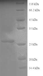 Human Collagen IV protein