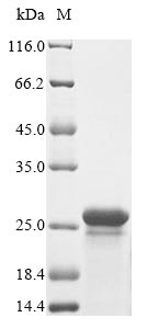 Human CRYGB protein