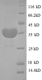 Human CSTB protein
