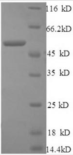 Human CTSB protein