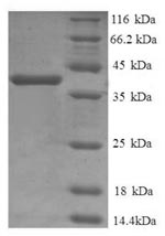 Human CTSD protein